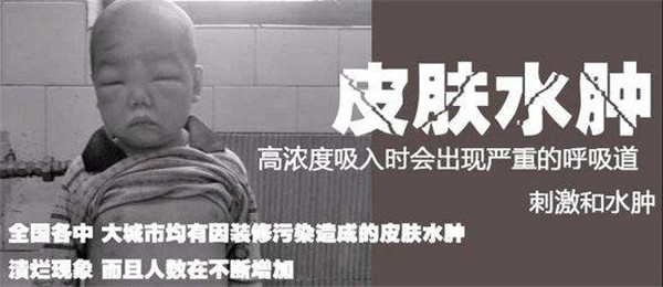 成都甲醛治理:维权遭遇踢皮球,一家三口甲醛中毒该怎么办? 成都甲醛治理:维权遭遇踢皮球,一家三口甲醛中毒该怎么办?